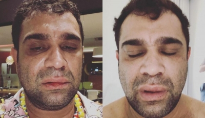 Humorista, ex-Pânico, é agredido após show na região 